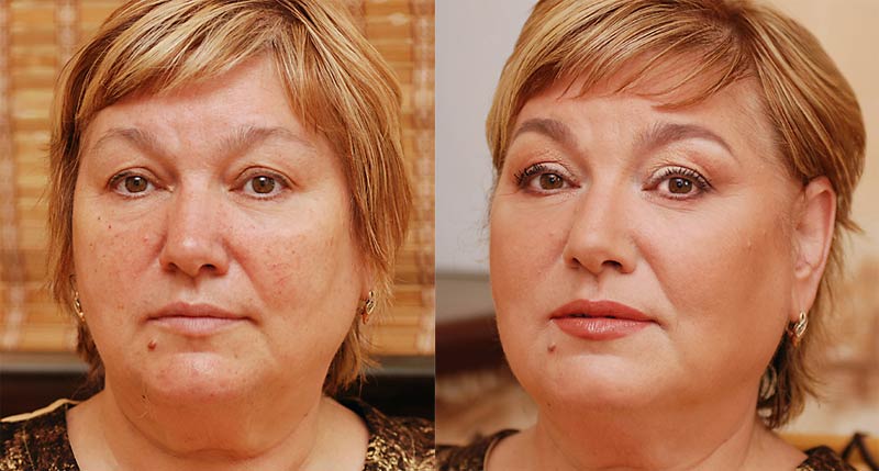 3 робочих антивікових засоби