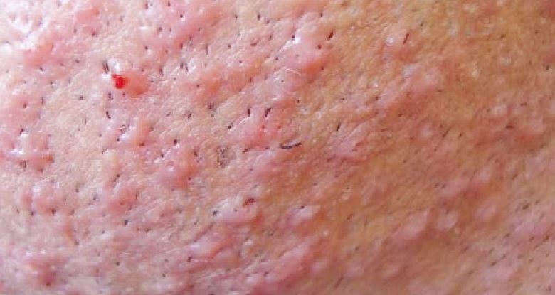 5 міфів у догляді за шкірою після гоління – що ми робимо?