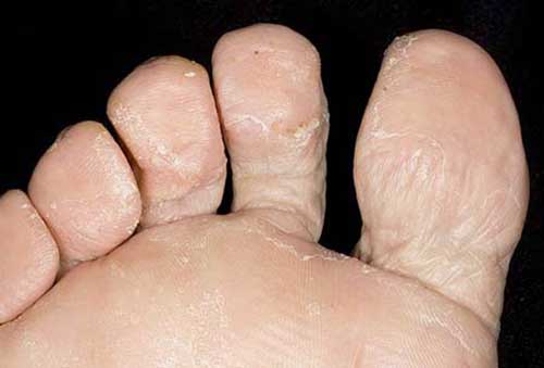 5 причин, чому варто міняти шкарпетки кожен день