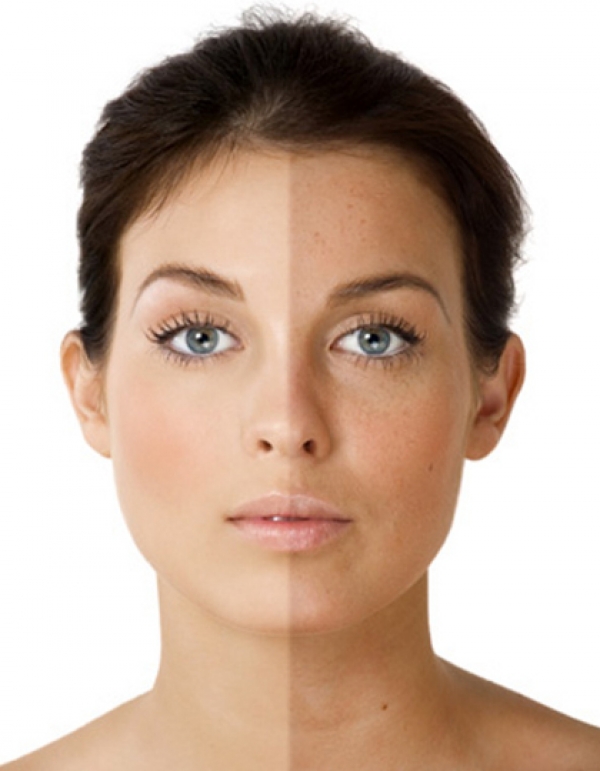 5 способів відбілити шкіру обличчя народними засобами