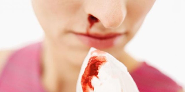 5 способів викликати кров з носа без болю в домашніх умовах