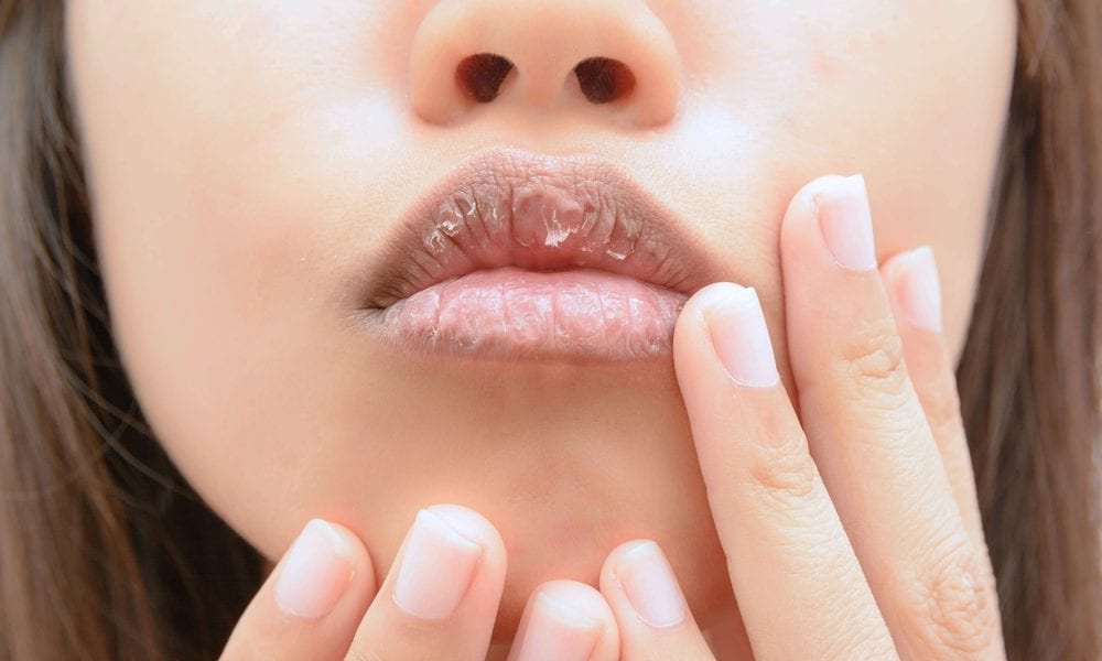 6 лайфхаков для щоденного догляду за губами – застосовуємо те, що виявиться на кухні