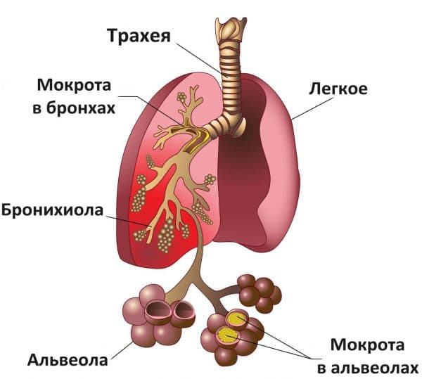 АЦЦ 100 для дітей при сухому кашлі інструкція по застосуванню препарату