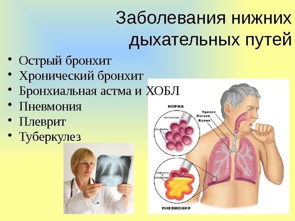 Амбробене для дітей — інструкція щодо застосування сиропу, таблеток та інших форм. Застосування сиропу Амбробене по інструкції для дорослих і радять його для дітей