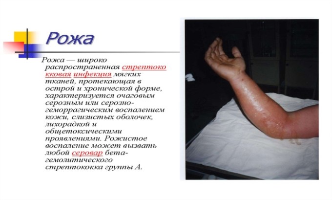 Амоксицилін Клавуланова кислота: інструкція по застосуванню