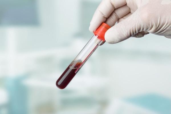 Аналіз крові при гаймориті — Поради отоларинголога