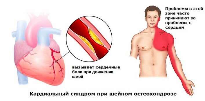 Анатомія шиї людини російською. Чому виникають і які бувають хвороби шиї людини? Межфасціальние простору шиї