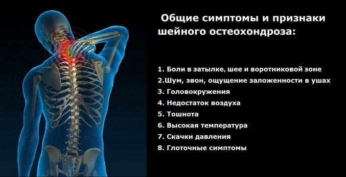 Анатомія шиї людини російською. Чому виникають і які бувають хвороби шиї людини? Межфасціальние простору шиї