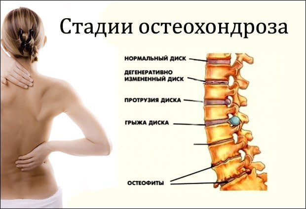 Анатомія шиї людини російською. Чому виникають і які бувають хвороби шиї людини? Межфасціальние простору шиї