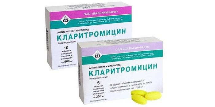 Ангіна грибкового типу