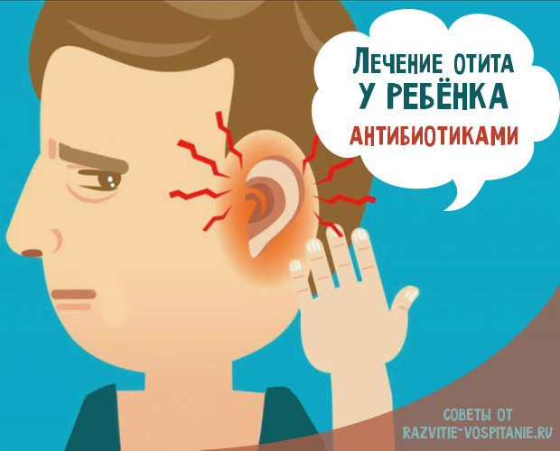 Антибіотик при отиту середнього вуха види та особливості лікування