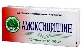 Антибіотики при фарингіті місцевої дії