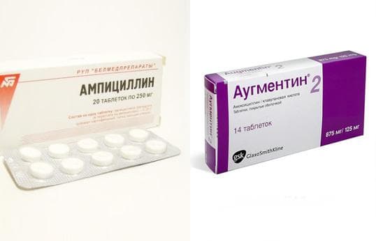 Антибіотики при гаймориті у дорослих: назви антибіотиків