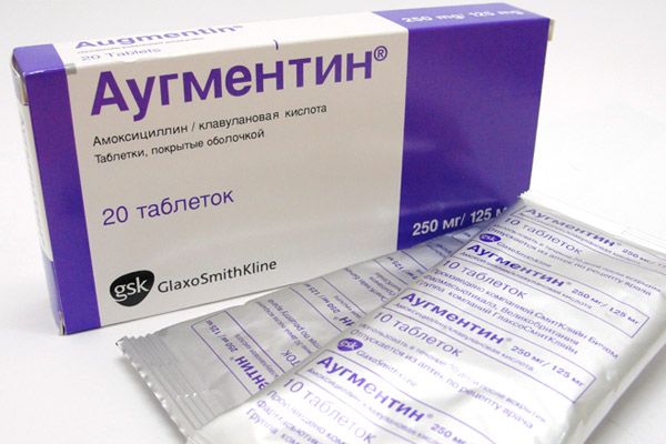 Антибіотики при гнійній ангіні – які краще пити та приймати при тонзиліті