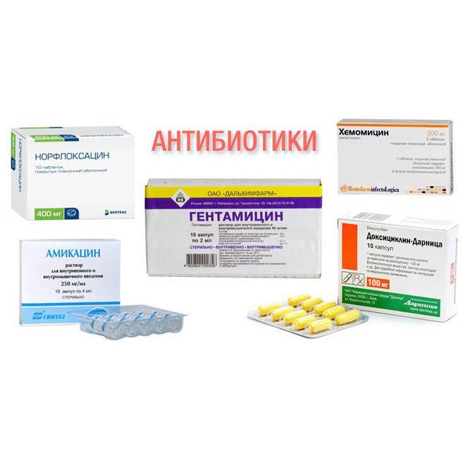 Антибіотики при ЛОР-захворюваннях огляд ефективних засобів