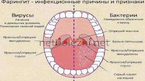 Антибіотики при нежиті і риніті у дорослих – найкращі засоби 2019