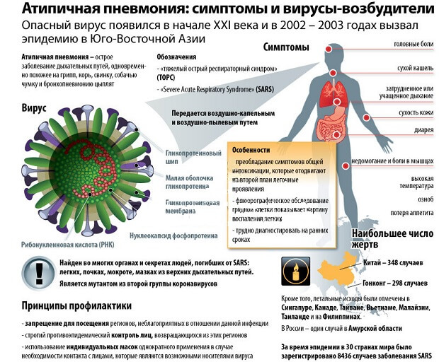 Атипова пневмонія: симптоми, у дорослих, лікування, ознаки