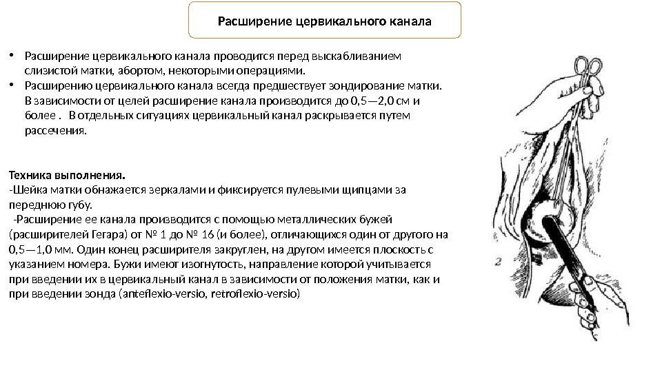 Атрезія матки: причини, симптоми і лікування