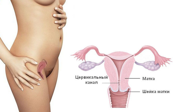 Атрезія матки: причини, симптоми і лікування