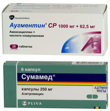 Аугментин або Сумамед у чому різниця і що краще