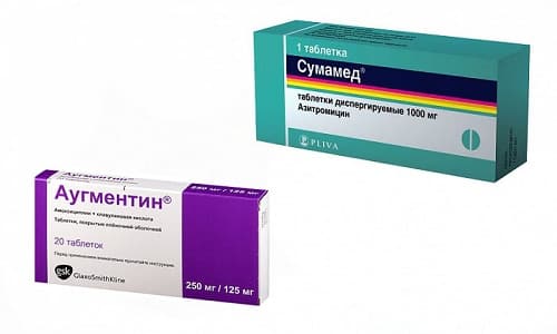 Аугментин або Сумамед у чому різниця і що краще