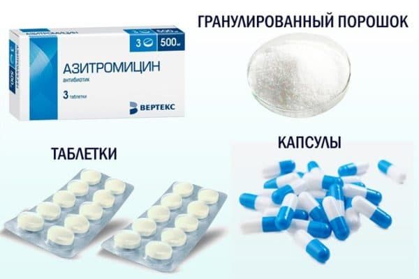 Азитроміцин при синуситі: відгуки, скільки приймати і як