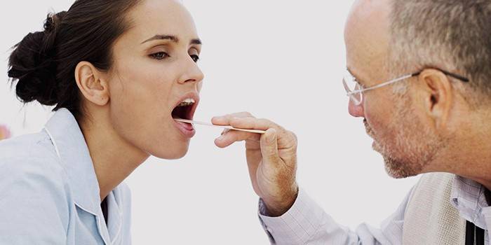 Білі крапки в горлі – як лікувати, про яку хвороби говорять