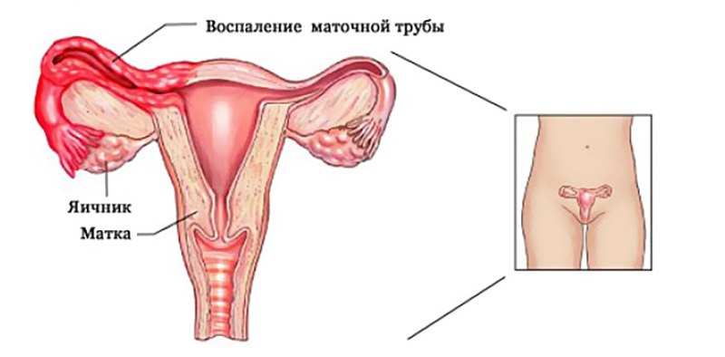 Біль у правому боці Біль у правому боці