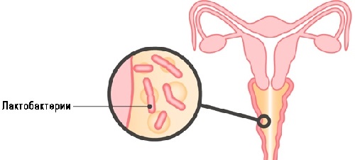 Бактеріальний вагіноз чим і як лікувати симптоми ознаки