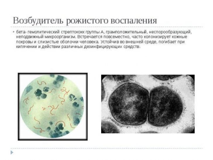 Бешихове запалення симптоми і лікування ознаки пики і форми бешихового запалення