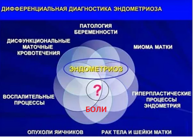 Болі при ендометріозі в області тіла матки: що робити, лікування