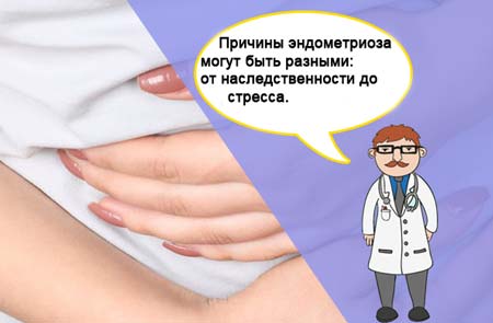Болі при ендометріозі в області тіла матки: що робити, лікування Болі при ендометріозі в області тіла матки: що робити, лікування