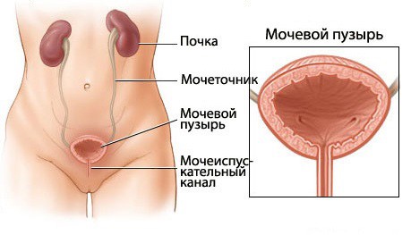 Болі в сечовому міхурі у жінок причини симптоми і лікування