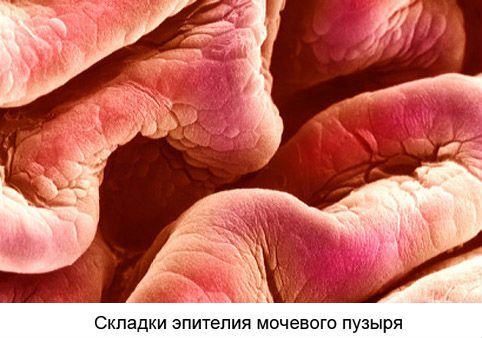 Болі в сечовому міхурі у жінок причини симптоми і лікування