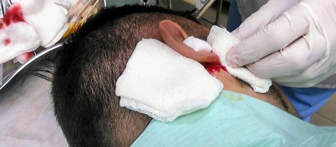 Болить голова і закладає вуха – чому так відбувається?