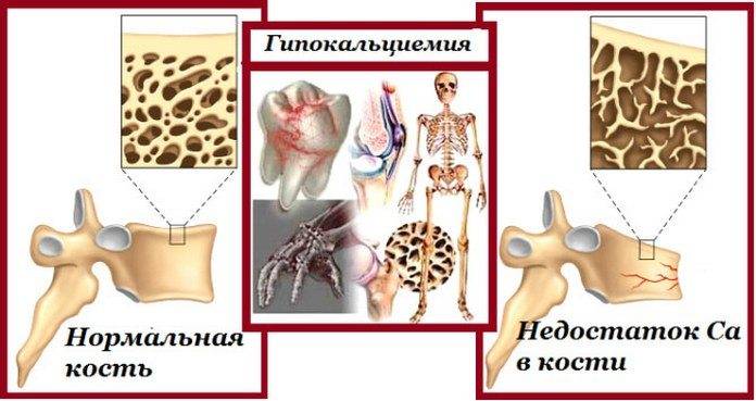 Болять всі суглоби тіла причина — Суглоби