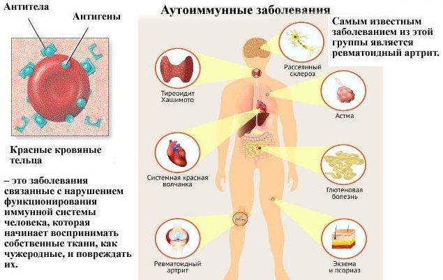 Болять всі суглоби тіла причина — Суглоби