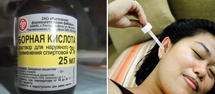 Борна кислота при отиті і болі у вусі