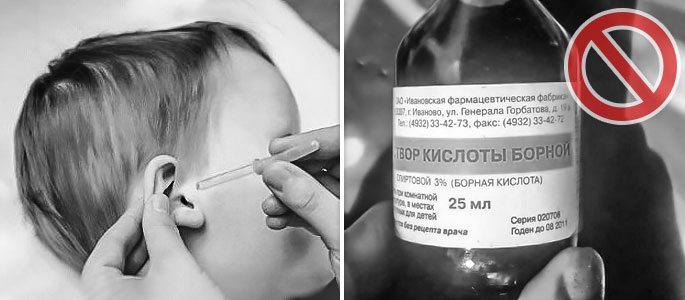 Борна кислота при отиті і болі у вусі