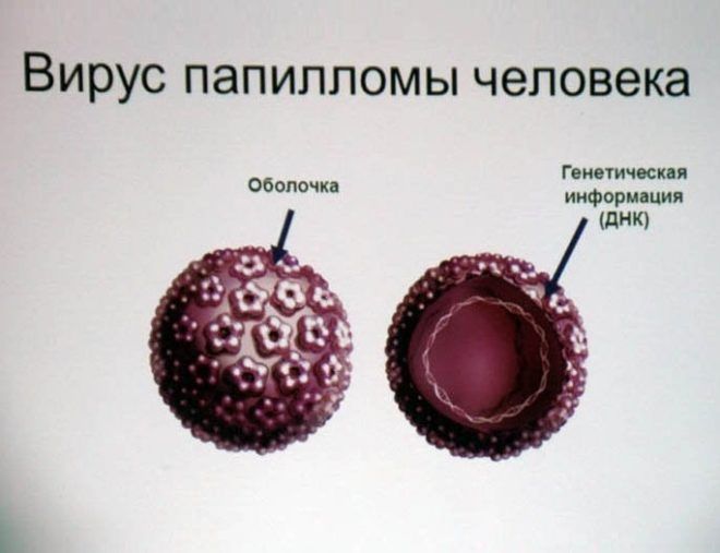 Бородавки на стопі у дитини лікування народними засобами