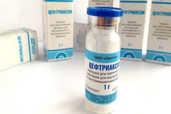 Цефтріаксон при ангіні: особливості лікування