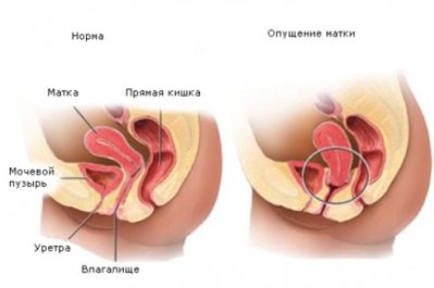 Часті позиви до сечовипускання у жінок без болю та з болем: причини, лікування