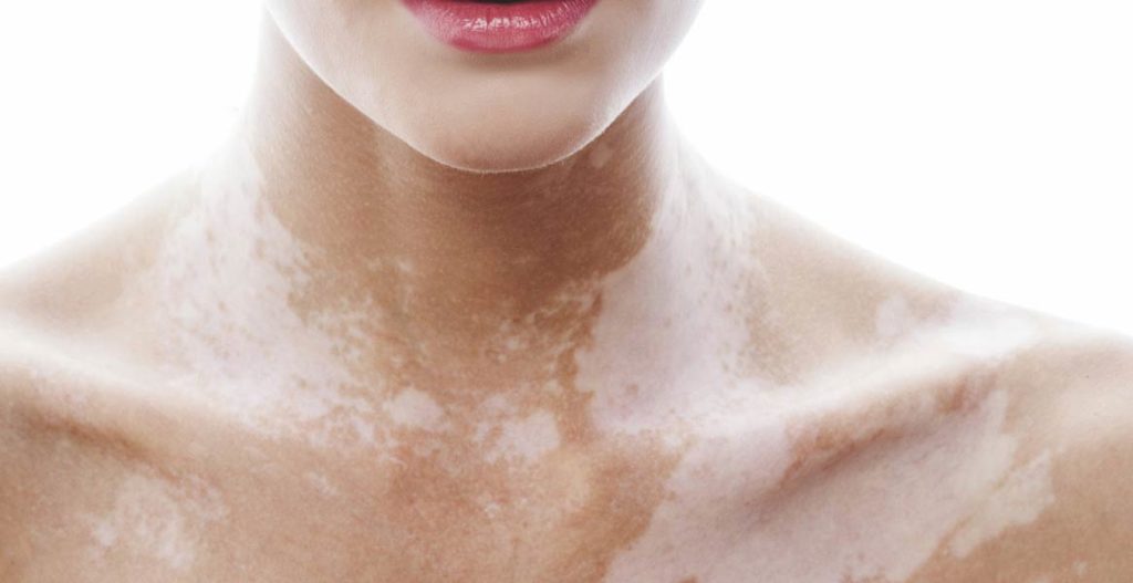 Часті проблеми з шкірою тіла і їх рішення