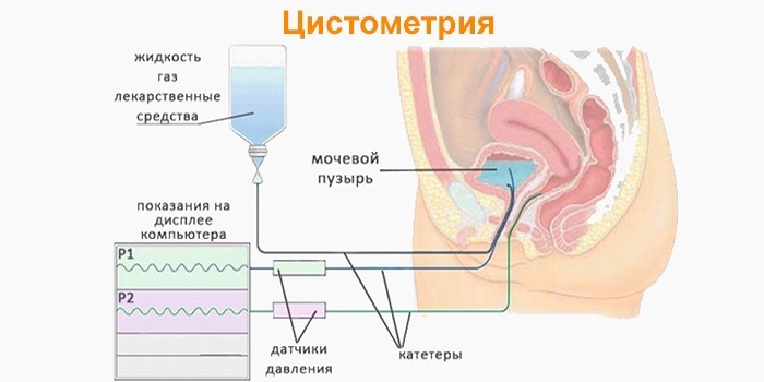 Часте хворобливе сечовипускання у жінок причини і що робити