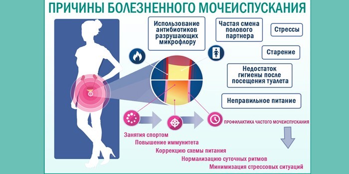 Часте хворобливе сечовипускання у жінок причини і що робити