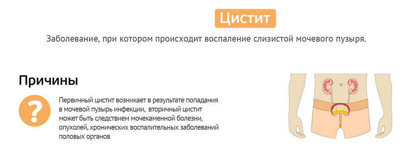 Часте сечовипускання безболісне у чоловіків. Часте сечовипускання безболісне у чоловіка – потрібно переживати