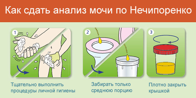 Часте сечовипускання у дітей без болю Часте сечовипускання у дітей без болю