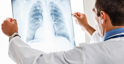 Чим небезпечна пневмонія у дорослих Чим небезпечна пневмонія у дорослих