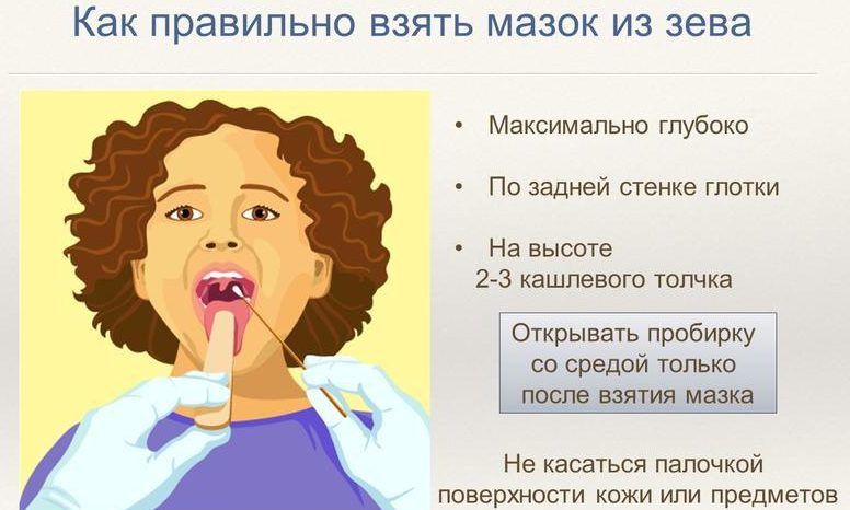 Чим небезпечний герпетичний фарингіт