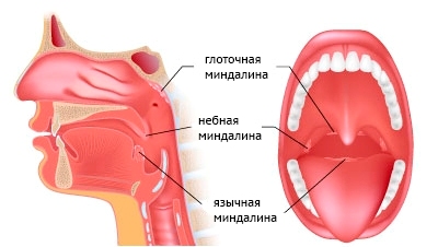 Чим небезпечний тонзиліт під час вагітності причини симптоми і методи лікування